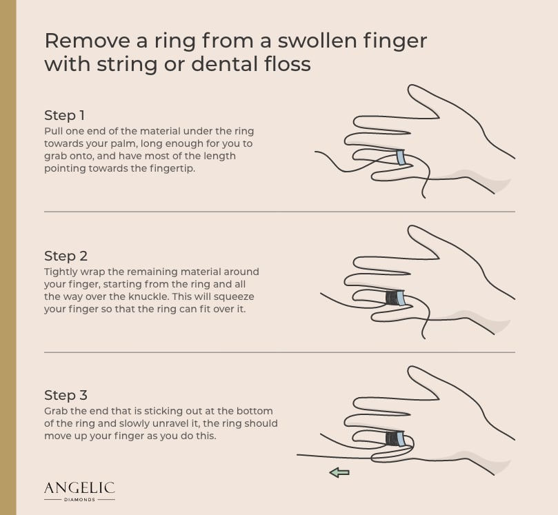 Removing ring from swollen finger deals